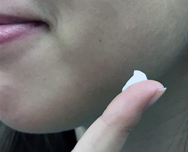 Pimple popping videos rise on YouTube