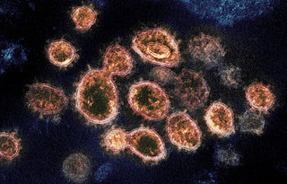 Understanding of COVID-19 outbreak varies